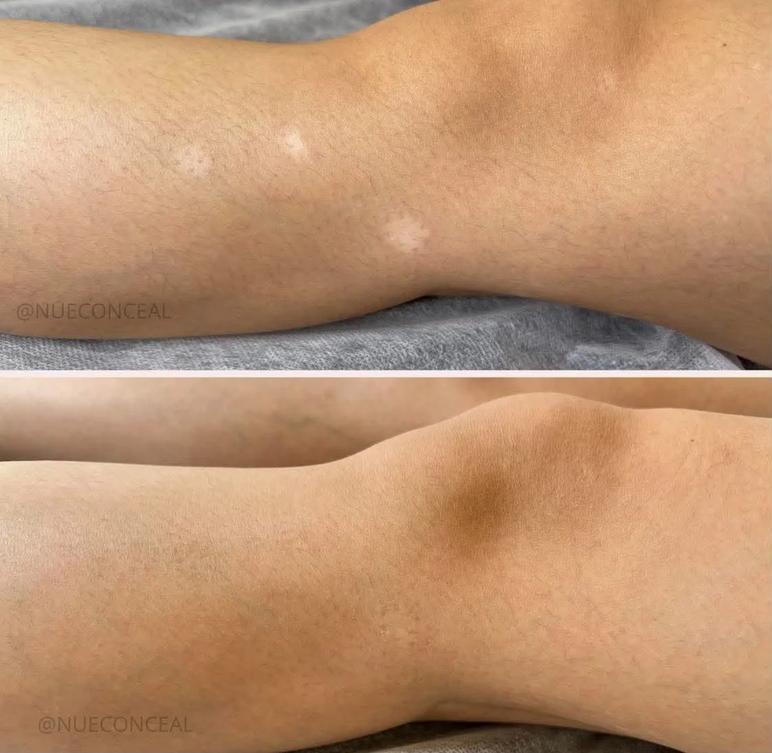 Scar camouflage before and after result